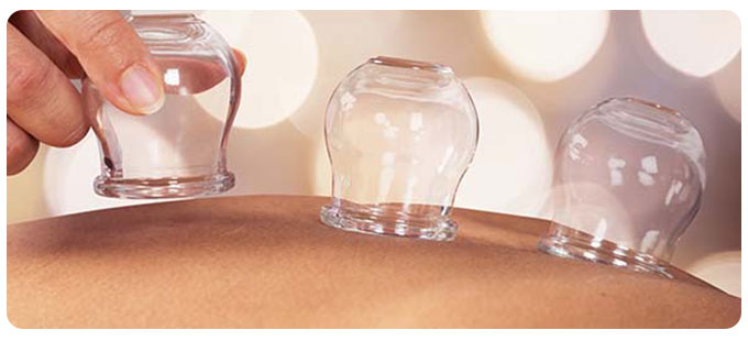 Cupping Treatment Clinic Near Me in South Surrey British Columbia