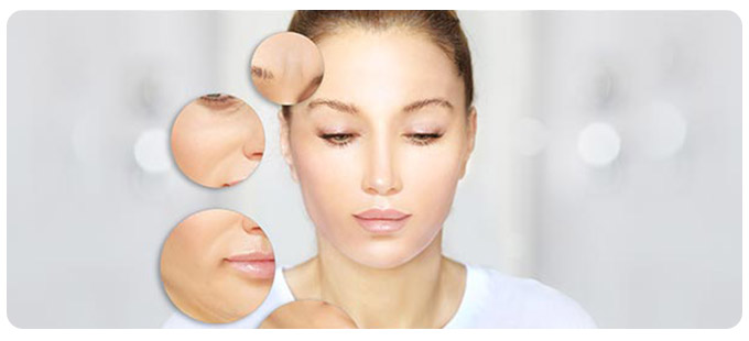 Marionette Lines Treatment Near Me in South Surrey BC Marionette Lines Treatment Near Me in South Surrey BC