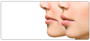 Nasolabial Fold Filler Treatment Near Me in South Surrey BC, and Burnaby BC Nasolabial Fold Filler Treatment Near Me in South Surrey BC, and Burnaby BC