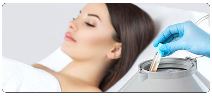 Benefits of PRP Treatments in South Surrey BC, and Burnaby BC Benefits of PRP Treatments in South Surrey BC, and Burnaby BC