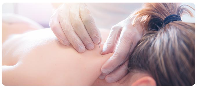 4 Questions to Ask About Acupuncture in South Surrey BC