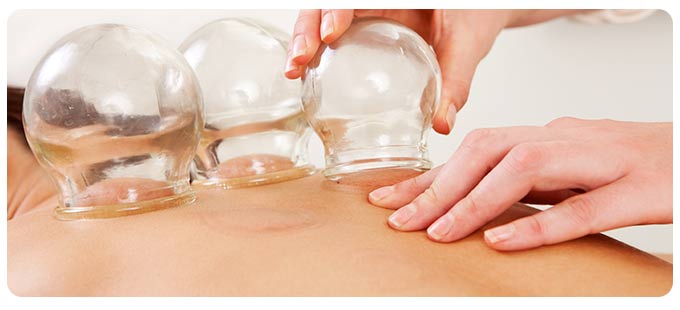 Cupping Therapy Clinic Near Me in South Surrey BC