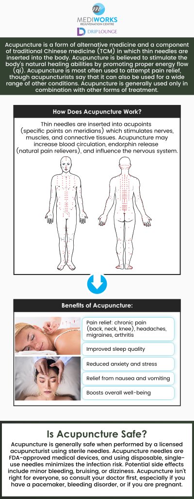 If you are looking for a good acupuncturist, then visit Mediworks Rejuvenation Centre and Drip Lounge, where our professionals are specialized in acupuncture therapy. For more information, contact us or request an appointment. We are conveniently located at Unit #103 – 15222 32nd Avenue Diversion, Surrey, BC V3Z 0R8, Canada. If you are looking for a good acupuncturist, then visit Mediworks Rejuvenation Centre and Drip Lounge, where our professionals are specialized in acupuncture therapy. For more information, contact us or request an appointment. We are conveniently located at Unit #103 – 15222 32nd Avenue Diversion, Surrey, BC V3Z 0R8, Canada.