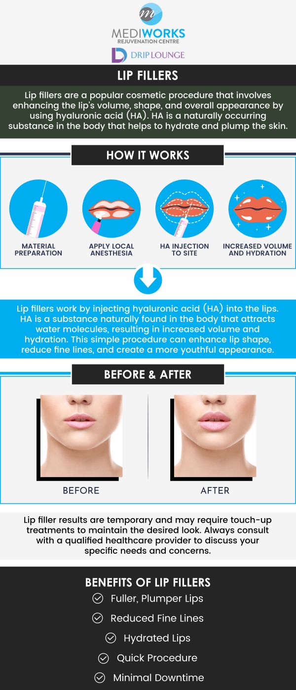 Get fuller, plumper lips with lip fillers offered at Mediworks Rejuvenation Centre. Lip Fillers can help you balance out the shape of your lips or add fullness. Interested in lip filler? Contact us today for more information or book an appointment online. We are conveniently located at Unit #103 – 15222 32nd Avenue Diversion, Surrey, BC V3Z 0R8, Canada. Get fuller, plumper lips with lip fillers offered at Mediworks Rejuvenation Centre. Lip Fillers can help you balance out the shape of your lips or add fullness. Interested in lip filler? Contact us today for more information or book an appointment online. We are conveniently located at Unit #103 – 15222 32nd Avenue Diversion, Surrey, BC V3Z 0R8, Canada.