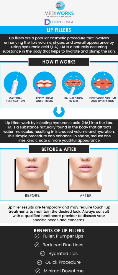 Mediworks Rejuvenation Centre offers lip injections to enhance the beauty of your lips. Lip injections can provide a long list of cosmetic benefits, to discover more visit us today. Contact us for more information or schedule an appointment online. We are conveniently located at Unit #103 – 15222 32nd Avenue Diversion, Surrey, BC V3Z 0R8, Canada. Mediworks Rejuvenation Centre offers lip injections to enhance the beauty of your lips. Lip injections can provide a long list of cosmetic benefits, to discover more visit us today. Contact us for more information or schedule an appointment online. We are conveniently located at Unit #103 – 15222 32nd Avenue Diversion, Surrey, BC V3Z 0R8, Canada.