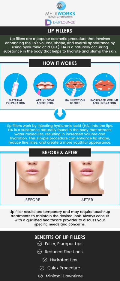 Get fuller, plumper lips with lip fillers offered at Mediworks Rejuvenation Centre. Lip Fillers can help you balance out the shape of your lips or add fullness. Interested in lip filler? Contact us today for more information or book an appointment online. We are conveniently located at Unit #103 – 15222 32nd Avenue Diversion, Surrey, BC V3Z 0R8, Canada. Get fuller, plumper lips with lip fillers offered at Mediworks Rejuvenation Centre. Lip Fillers can help you balance out the shape of your lips or add fullness. Interested in lip filler? Contact us today for more information or book an appointment online. We are conveniently located at Unit #103 – 15222 32nd Avenue Diversion, Surrey, BC V3Z 0R8, Canada.