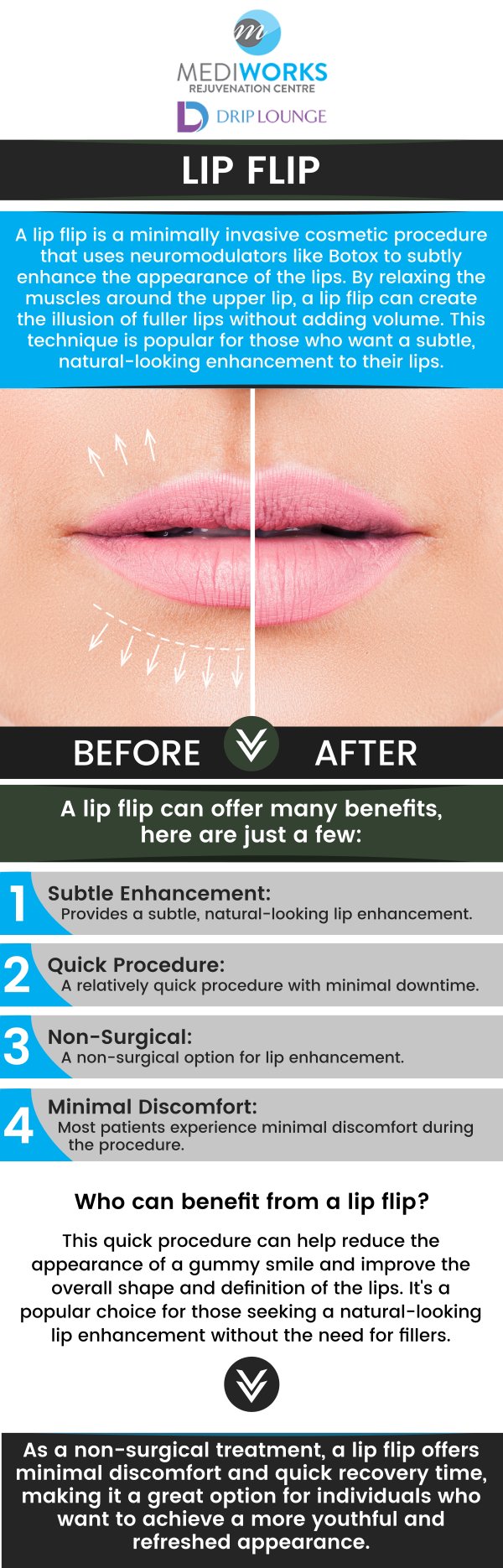 Wants to get the pouty look? At Mediworks Rejuvenation Centre we offer lip flip to get more fuller looking lips. For more information, contact us or book an appointment online. We are conveniently located at Unit #103 – 15222 32nd Avenue Diversion, Surrey, BC V3Z 0R8, Canada. Wants to get the pouty look? At Mediworks Rejuvenation Centre we offer lip flip to get more fuller looking lips. For more information, contact us or book an appointment online. We are conveniently located at Unit #103 – 15222 32nd Avenue Diversion, Surrey, BC V3Z 0R8, Canada.
