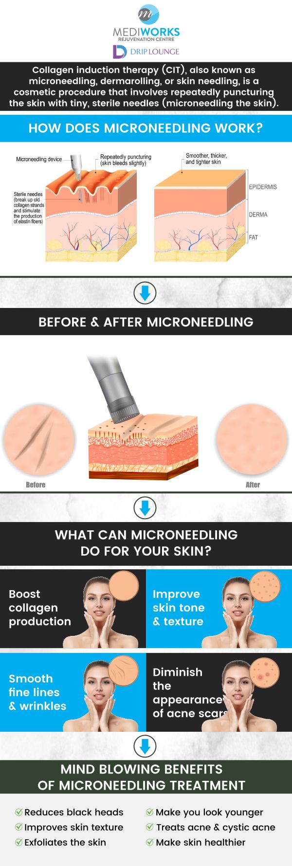 Are you looking to reduce fine lines, wrinkles, or scars? Microneedling is one solution for you offered at Mediworks Rejuvenation Centre. For more information, contact us or book an appointment online. We are conveniently located at Unit #103 – 15222 32nd Avenue Diversion, Surrey, BC V3Z 0R8, Canada. Are you looking to reduce fine lines, wrinkles, or scars? Microneedling is one solution for you offered at Mediworks Rejuvenation Centre. For more information, contact us or book an appointment online. We are conveniently located at Unit #103 – 15222 32nd Avenue Diversion, Surrey, BC V3Z 0R8, Canada.