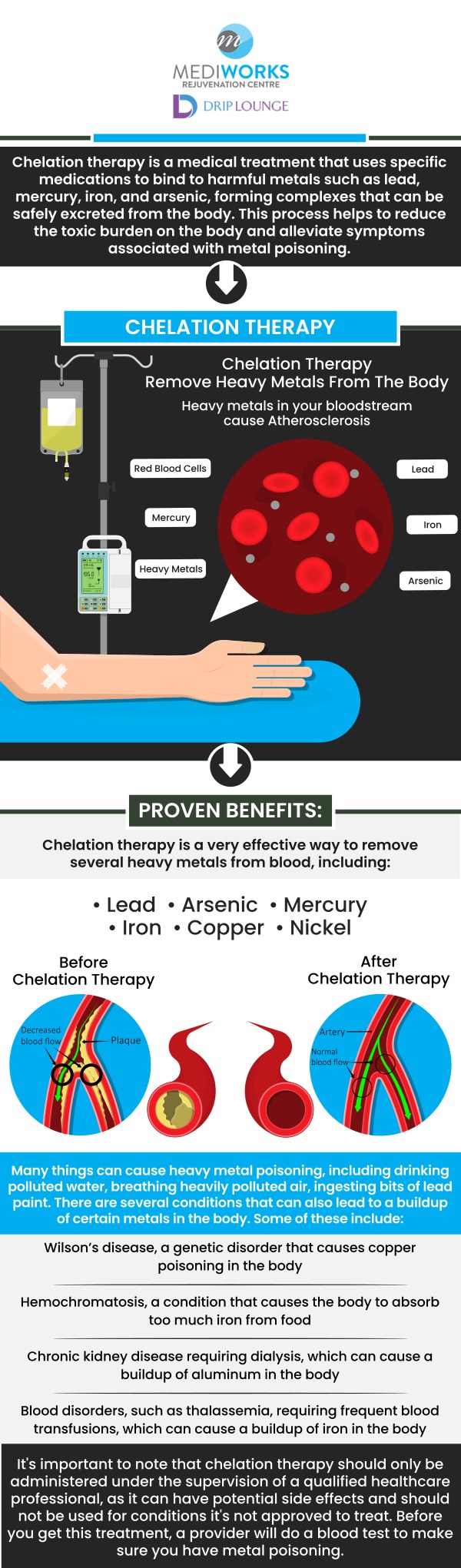 Mediworks Rejuvenation Centre and Drip Lounge offers chelation therapy that removes heavy metals such as lead, iron or mercury from your body. To find out if Chelation therapy would be right for you contact us today or make an appointment. We are conveniently located at Unit #103 – 15222 32nd Avenue Diversion, Surrey, BC V3Z 0R8, Canada.